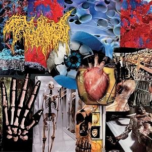 CD Shop - TRICHOMONIASIS HARVEST OF THE KILLING...