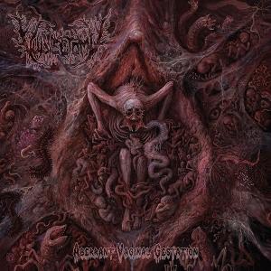 CD Shop - VULVECTOMY ABERANT VAGINAL GESTATION